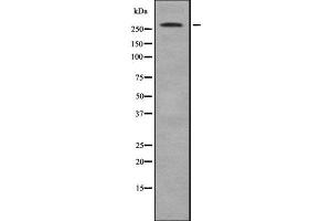 Western blot analysis of ACACB using MCF7 whole  lysates. (Acetyl-CoA Carboxylase beta 抗体  (N-Term))