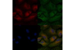 ABIN6259968 and ABIN6266497 staining  cells by IF/ICC. (APAF1 抗体  (C-Term))