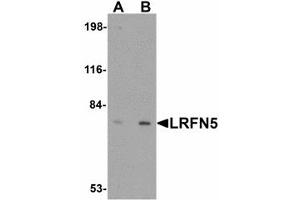 Image no. 1 for anti-Leucine Rich Repeat and Fibronectin Type III Domain Containing 5 (LRFN5) (C-Term) antibody (ABIN478054) (LRFN5 抗体  (C-Term))