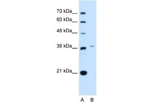 WB Suggested Anti-LHX8 Antibody Titration:  2. (LHX8 抗体  (Middle Region))