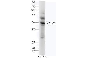 Mouse liver lysates probed with Anti-CYP7A1 Polyclonal Antibody, Unconjugated (ABIN739725) at 1:300 in 4˚C. (CYP7A1 抗体  (AA 351-400))