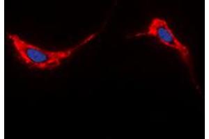 Immunofluorescent analysis of Aquaporin 2 staining in HeLa cells. (AQP2 抗体  (C-Term))