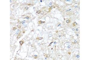 Immunohistochemistry (Paraffin-embedded Sections) (IHC (p)) image for anti-Ras-Related C3 Botulinum Toxin Substrate 2 (Rho Family, Small GTP Binding Protein Rac2) (RAC2) antibody (ABIN7255610)
