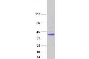 Validation with Western Blot (KCTD7 Protein (Transcript Variant 2) (Myc-DYKDDDDK Tag))
