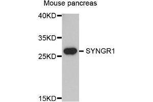 Western blot analysis of extracts of mouse pancreas, using SYNGR1 antibody. (Synaptogyrin 1 抗体)
