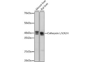 Western blot analysis of extracts of various cell lines, using Cathepsin L/V/K/H Rabbit mAb (ABIN7266150) at 1:1000 dilution. (Cathepsin L 抗体)