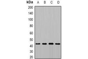 Western blot analysis of MTCH1 expression in MCF7 (A), HepG2 (B), mouse kidney (C), rat brain (D) whole cell lysates. (MTCH1 抗体)