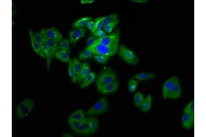 Immunofluorescence staining of HepG2 cells with ABIN7162587 at 1:133, counter-stained with DAPI. (Pannexin 2 抗体  (AA 370-470))