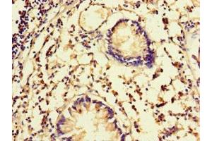 Immunohistochemistry of paraffin-embedded human appendix tissue using ABIN7152505 at dilution of 1:100 (FBXW5 抗体  (AA 265-494))