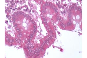 Human Colon: Formalin-Fixed, Paraffin-Embedded (FFPE) (BACE1 抗体  (C-Term))