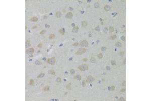 Immunohistochemistry (Paraffin-embedded Sections) (IHC (p)) image for anti-Hydroxysteroid (17-Beta) Dehydrogenase 13 (HSD17B13) (AA 20-300) antibody (ABIN6142006)
