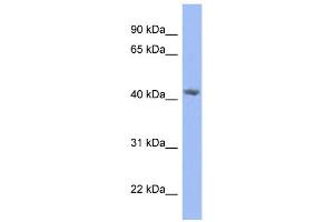 WB Suggested Anti-PRPSAP2 Antibody Titration: 0. (PRPSAP2 抗体  (N-Term))