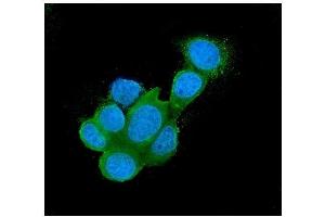 IF analysis of Galectin 3/LGALS3 using anti-Galectin 3/LGALS3 antibody (ABIN6719486).