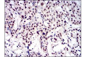 Immunohistochemistry (IHC) image for anti-Catenin, beta Like 1 (CTNNBL1) (AA 390-557) antibody (ABIN2682986)