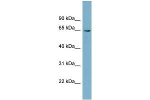 WB Suggested Anti-PGM3 Antibody Titration: 0. (Phosphoglucomutase 3 抗体  (N-Term))