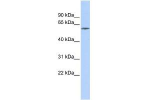 WB Suggested Anti-ZNF205 Antibody Titration:  0. (ZNF205 抗体  (Middle Region))