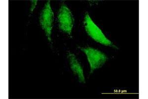 Immunofluorescence of purified MaxPab antibody to HECTD2 on HeLa cell. (HECTD2 抗体  (AA 1-207))