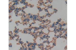 Immunohistochemistry (IHC) image for anti-Tumor Necrosis Factor Receptor Superfamily, Member 19 (TNFRSF19) (AA 61-163) antibody (ABIN5014480)