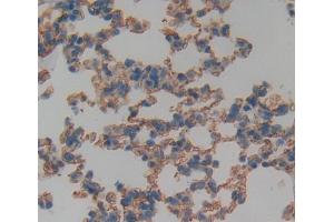 Used in DAB staining on fromalin fixed paraffin- embedded Kidney tissue (TNFRSF19 抗体  (AA 61-163))