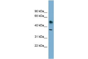 Western Blotting (WB) image for anti-ATPase, Na+/K+ Transporting, beta 1 Polypeptide (ATP1B1) (N-Term) antibody (ABIN2781851)
