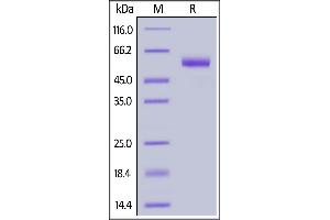 SDS-PAGE (SDS) image for CD7 (CD7) (AA 26-180) (Active) protein (Fc Tag) (ABIN6950992)