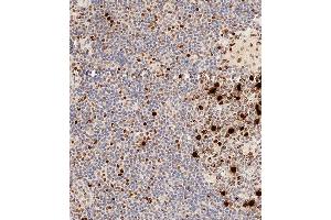 Immunohistochemical analysis of paraffin-embedded Human tonsil tissue using A performed on the Leica® BOND RXm. (HIST1H3B3 (pSer10) 抗体)