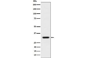 Western blot analysis of BCL2L12 expression in MCF7 cell lysate. (Recombinant BCL2L12 抗体)