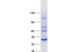 Potassium Channel Tetramerisation Domain Containing 14 (KCTD14) protein (Myc-DYKDDDDK Tag)