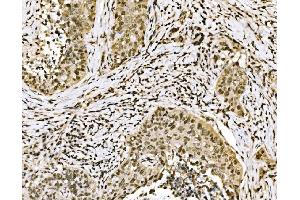 IHC analysis of SPHK1 using anti-SPHK1 antibody (ABIN7600168).