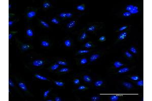 Immunofluorescence of monoclonal antibody to ZNF100 on HeLa cell. (ZNF100 抗体  (AA 99-206))