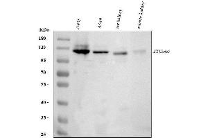 Western blot analysis of ITGA6 using anti-ITGA6 antibody (ABIN6719411).
