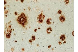 Immunohistochemistry (IHC) image for anti-Abeta 38/40/42 (AA 1-16), (AA 4-8) antibody (ABIN1742439) (Abeta 38/40/42 (AA 1-16), (AA 4-8) 抗体)