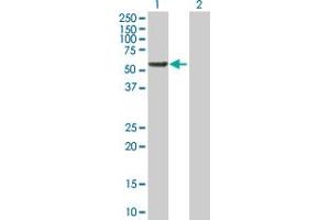 Western Blot analysis of RGS6 expression in transfected 293T cell line by RGS6 MaxPab polyclonal antibody. (RGS6 抗体  (AA 1-472))