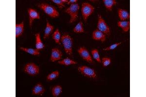IF analysis of Elovl4 using anti-Elovl4 antibody (ABIN7599257). (ELOVL4 抗体  (AA 1-312))