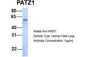 Western Blotting (WB) image for anti-Zinc Finger Protein 278 (ZNF278) (N-Term) antibody (ABIN2779693)