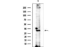 anti-2,4-Dienoyl CoA Reductase 1, Mitochondrial (DECR1) antibody