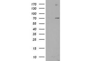 Image no. 3 for anti-SUMO1/sentrin/SMT3 Specific Peptidase 2 (SENP2) (AA 139-523) antibody (ABIN1490931)