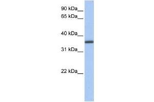 Western Blotting (WB) image for anti-UDP-Galactose-4-Epimerase (GALE) antibody (ABIN2459745) (GALE 抗体)