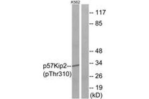 Western blot analysis of extracts from K562 cells treated with insulin 0. (CDKN1C 抗体  (pThr310))