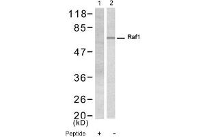 Image no. 1 for anti-V-Raf-1 Murine Leukemia Viral Oncogene Homolog 1 (RAF1) (Ser338) antibody (ABIN319325) (RAF1 抗体  (Ser338))