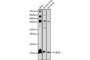 Western blot analysis of extracts of various cell lines, using S100 antibody (ABIN1682611, ABIN3018540, ABIN3018541 and ABIN5664641) at 1:1000 dilution. (S100A6 抗体  (AA 1-90))