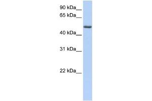 WB Suggested Anti-PHLDA1 Antibody Titration: 0. (PHLDA1 抗体  (C-Term))