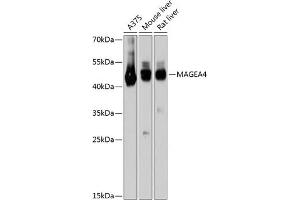 Western blot analysis of extracts of various cell lines, using M antibody (ABIN6128211, ABIN6143437, ABIN6143438 and ABIN6215295) at 1:3000 dilution. (MAGEA4 抗体  (AA 28-317))