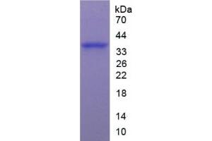 SDS-PAGE of Protein Standard from the Kit (Highly purified E. (ARG ELISA 试剂盒)