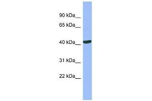 SERPINB13 antibody used at 1 ug/ml to detect target protein. (SERPINB13 抗体)