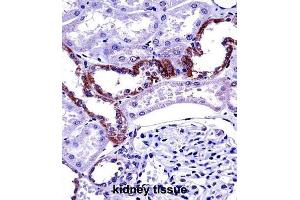 Immunohistochemistry (IHC) image for anti-Mucolipin 1 (MCOLN1) antibody (ABIN2997394) (MCOLN1 抗体)