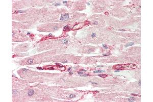 Human, Heart: Formalin-Fixed Paraffin-Embedded (FFPE). (LRRC14 抗体  (AA 412-461))