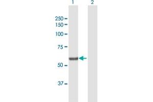 Western Blot analysis of SGPL1 expression in transfected 293T cell line by SGPL1 MaxPab polyclonal antibody. (SGPL1 抗体  (AA 1-568))