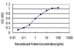 Detection limit for recombinant GST tagged QPRT is approximately 0. (QPRT 抗体  (AA 198-297))