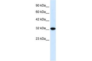 Western Blotting (WB) image for anti-Zinc Finger and BTB Domain Containing 32 (ZBTB32) antibody (ABIN2460305) (ZBTB32 抗体)